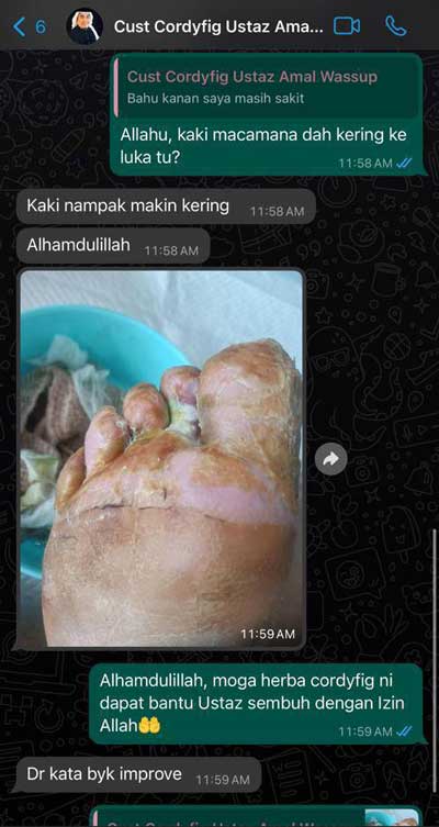 testimoni-cordyfig-01